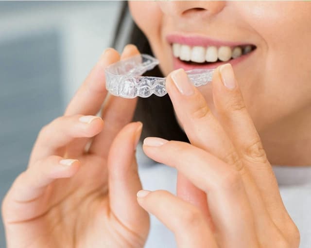 dental veneers birmingham