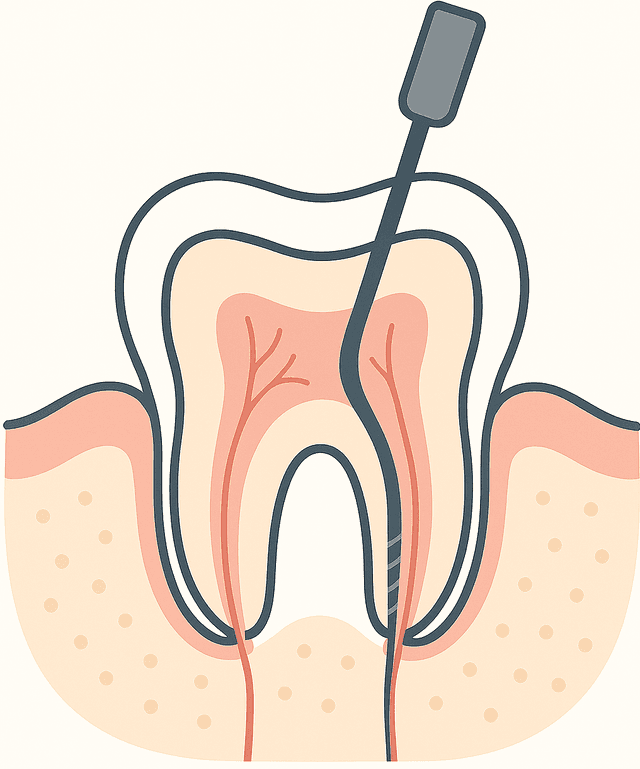 root canal treatment birmingham
